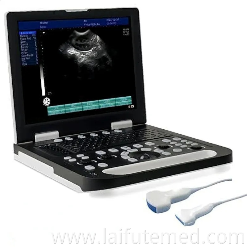 Portable 4D Ultrasound Machine Veterinary Instrument for Medical Diagnostic Imaging Centers Equipment for Sale